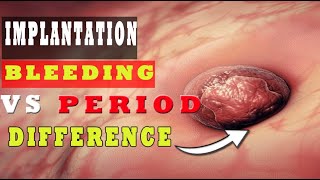 Implantation Bleeding Vs Period – How to Know the Difference 🩸🩸 [upl. by Winthrop]