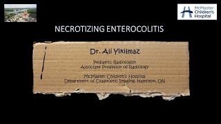 Necrotizing Enterocolitis [upl. by Giule465]