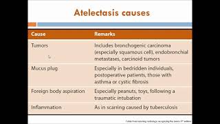 Lecture 5  Opacified hemithorax atelectasis and pleural effusion [upl. by Nathan]