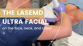 Lutronic LaseMD Ultra Face Neck and Chest Treatment at Skin Renew Day Spa and Laser Center [upl. by Anoblav]