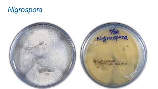 Identification of Melanized Dermatitiaceous Fungi Part 1 Hot Topic [upl. by Stav29]