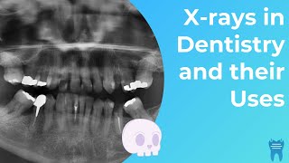 Types of Dental Xrays you NEED to know  Dental Radiographs and Why we use them [upl. by Burris661]