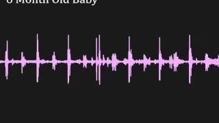 Recorded babys heartbeat from a 6 month old infant [upl. by Ernesto]