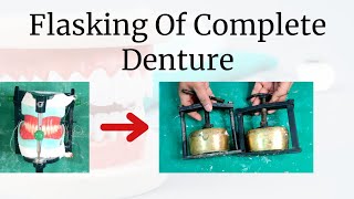 Flasking of Complete Denture [upl. by Anairuy501]