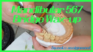 crownampbridge관교 mandibular 567 Bridge wax up  하악 567 브릿지 왁스업 [upl. by Molohs]