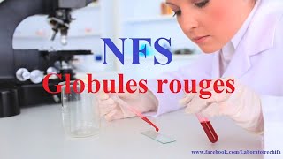 NFS Globules rouges [upl. by Freberg872]