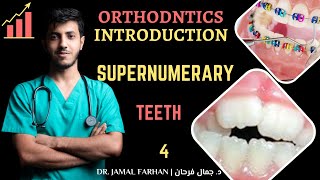 ORTHODONTIC  Lecture 2  Part 4  Supernumerary teeth  كورس تقويم الاسنان [upl. by Ettenoj24]