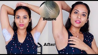 Live Result In Just 10 minutes Dark Underarm Whitening 100 Works [upl. by Seftton]