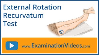 External Rotation Recurvatum Test [upl. by Nosdivad699]