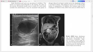 PAEDIATRIC IMAGING [upl. by Zolnay889]