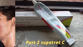 Supatret c Gel  Part 2 [upl. by Laroc]