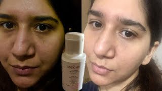 Kozicare Skin Whitening Fairness Oil  acne scar  Beauty  Skin care  Brijwasi Girl  Face oil [upl. by Benito]