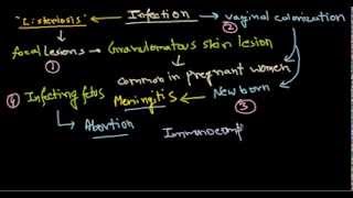 Listeria monocytogenes infection [upl. by Ginny]