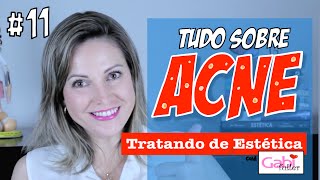 Tudo sobre Acne  Aula Teórica [upl. by Fancie]