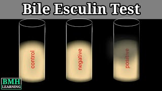 Bile Esculin Test  Bile Esculin Test For Enterococcus Identification  Bile Esculin Agar [upl. by Aipotu]