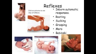 newborn reflexes [upl. by Llevol7]