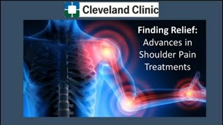 Finding Relief Advancements in Shoulder Pain Treatments [upl. by Aenyl259]