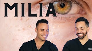 Milia removal using radio frequency [upl. by Strephonn]