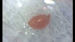 BXA mite head emerges when borax water is introduced to mite [upl. by Naujud]