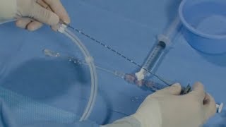 Cardiac Catheterization What You Can Expect [upl. by Droflim]