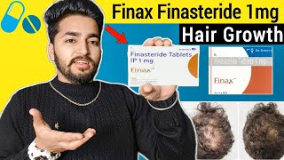 Finax Finasteride Review  Finax Finasteride Side Effects [upl. by Siahc]