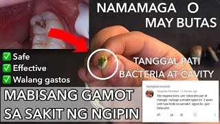 Effective tips at Mabisang Gamot sa sakit ng ngipin  Ito na ang gamot na hinahanap niyo [upl. by Arel]