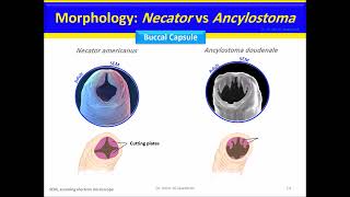 Nematodes Hookworm Ancylostoma duodenale Necator americanus [upl. by Umberto]