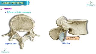 Anatomy of Lumbar vertebrae Osteology USMLE  Typical and Atypical lumbar vertebra [upl. by Fannie356]