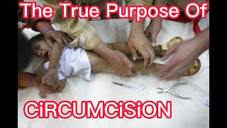 What is CiRCUMCiSiON pros cons benefits amp definition [upl. by Alessig]