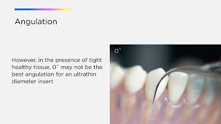 Optimize Your Cavitron Technology Cavitron® Thinsert® Insert [upl. by Ahtanaram744]