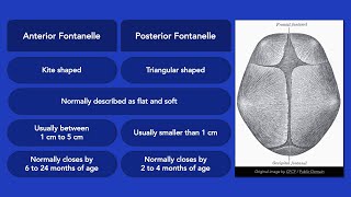 Fontanelles [upl. by Minetta]