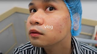 eng sub Acne Scar Treatment  PICO Laser  TCA Cross  Subcision  3rd Session  Philippines [upl. by Philomena]