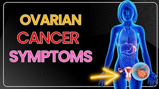 Ovarian Cancer Part 2  Obstetrics and gynaecology Video lectures [upl. by Eoz]