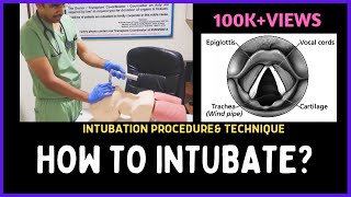 HOW TO INTUBATE INTUBATION PROCEDURE amp TECHNIQUE [upl. by Florry]