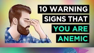 Top 10 Signs of ANEMIA [upl. by Grassi766]