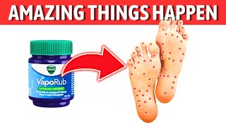 Rub VICKS VapoRub on Your FEET and Feel What Happens  Dr Mandell [upl. by Jo Ann]