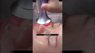 ASMR Facial massage and skin rejuvenation laser treatment for women skincare relax [upl. by Nesahc]