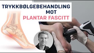 Effektiv Trykkbølgebehandling mot Plantar Fascitt [upl. by Publus]