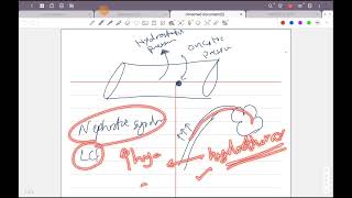 Ch5 Chest pleurisy [upl. by Narcho]