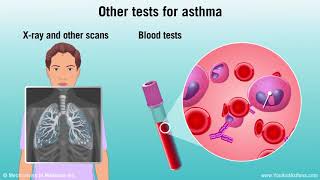 Bronchiolitis diagnosis  Respiratory system diseases  NCLEXRN  Khan Academy [upl. by Ramad]