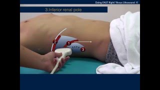 5 minute How to do FAST ultrasound like expert [upl. by Ainoloppa792]