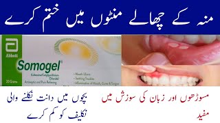 somogel for mouth ulcers  somogel  sumo gel  somogel lagane ka tarika  mouth ulcer treatment [upl. by Nirret212]