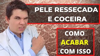 COCEIRA E PELE RESSECADA Como acabar com isso DICAS PARA PELE SECA [upl. by Hurff]