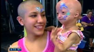 Adalia Rose holds fundraiser for Progeria [upl. by Reffotsirk]