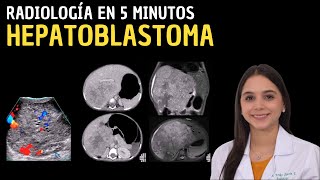 Radiología en 5 minutos Hepatoblastoma [upl. by Akiaki]