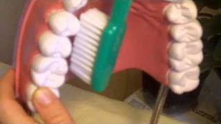 Gum Disease Remedy Receding Gums Treatment [upl. by Notyarb]