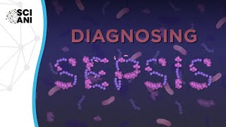 Diagnosing Sepsis [upl. by Dorkus]