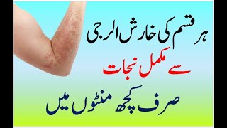 Skin Allergy Treatment At Home  Kharish Ka Ilaj In Urdu  Allergy Khatam Karne Ka Tarika [upl. by Nertie23]