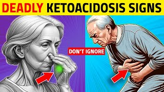 7 Deadly Ketoacidosis Signs Most Diabetics Ignore [upl. by Terencio434]