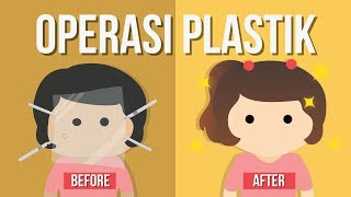 Apakah Operasi Plastik Pakai “Plastik” [upl. by Euton]